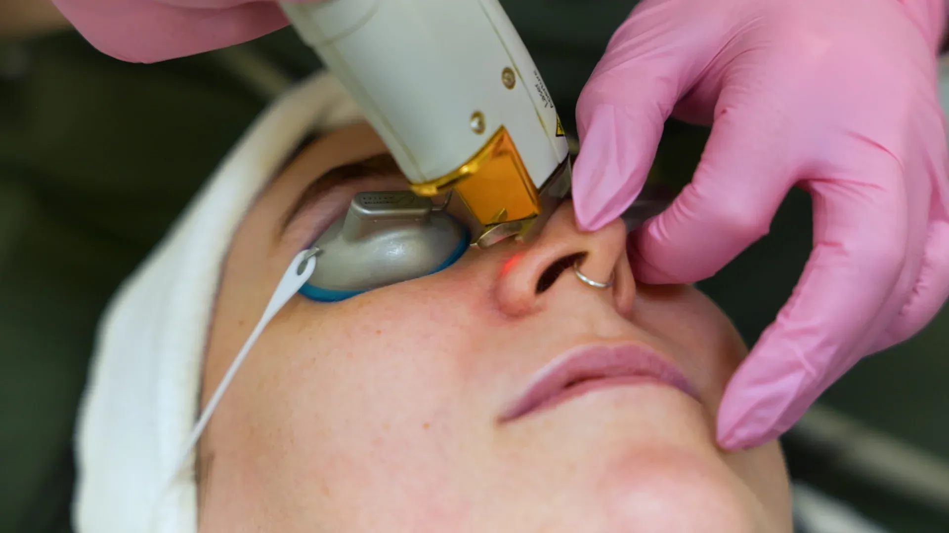 PicoWay Tattoo Removal Gallery 6