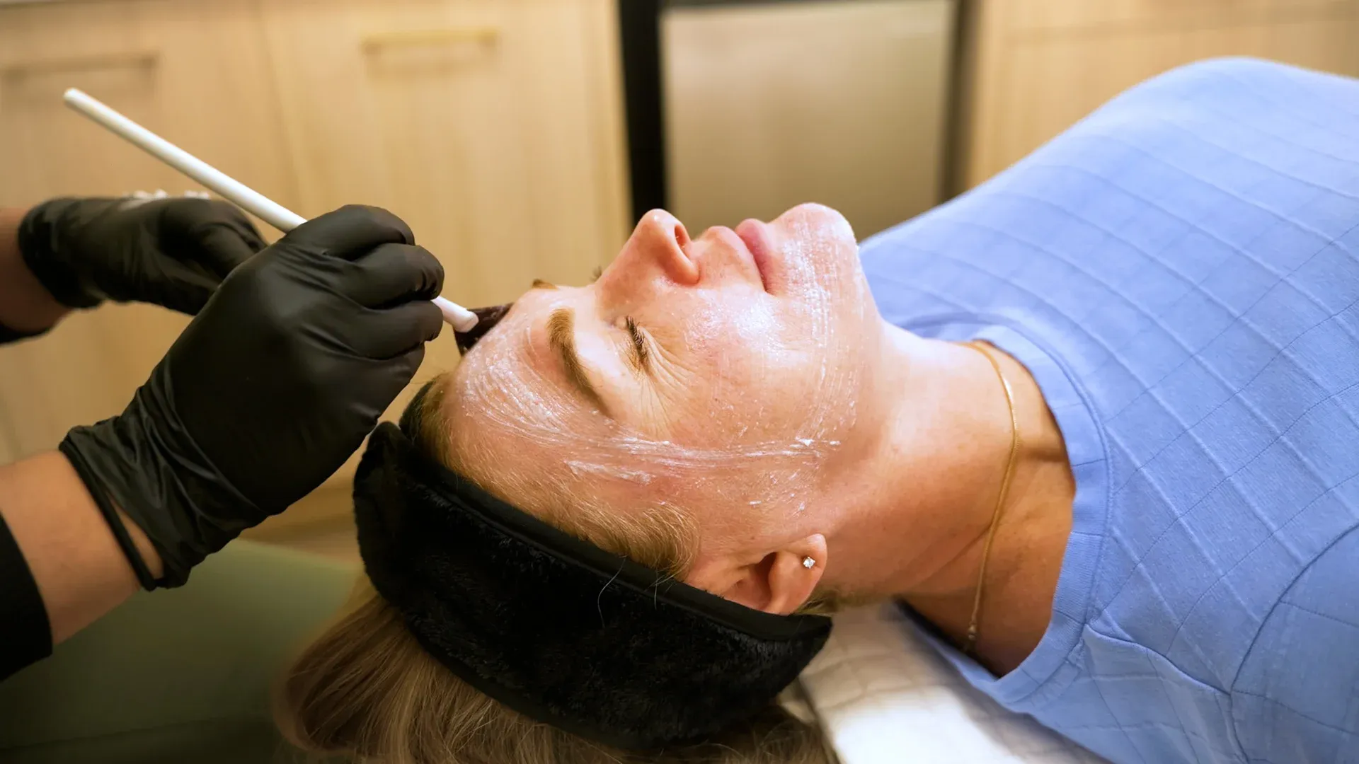 PicoWay Laser Tattoo Removal Process