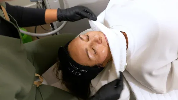 PicoWay Tattoo Removal Gallery 3