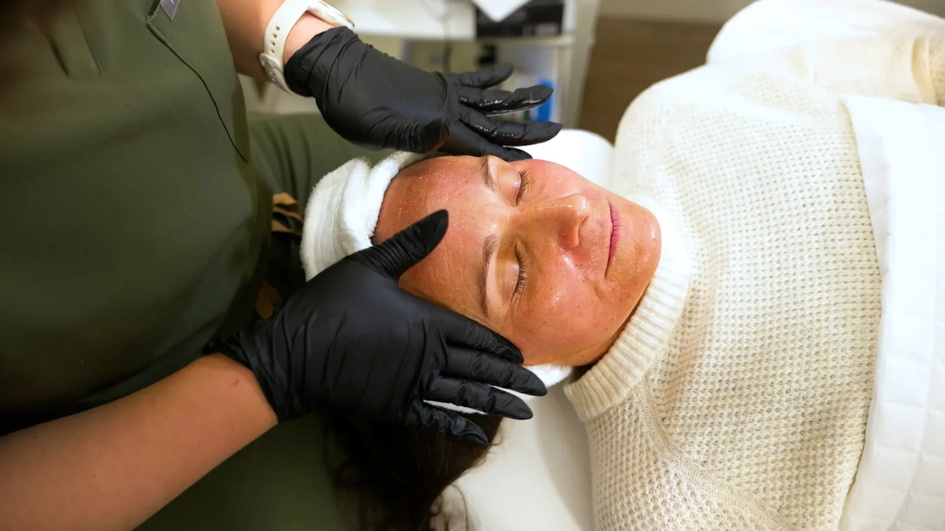 PicoWay Tattoo Removal Gallery 1