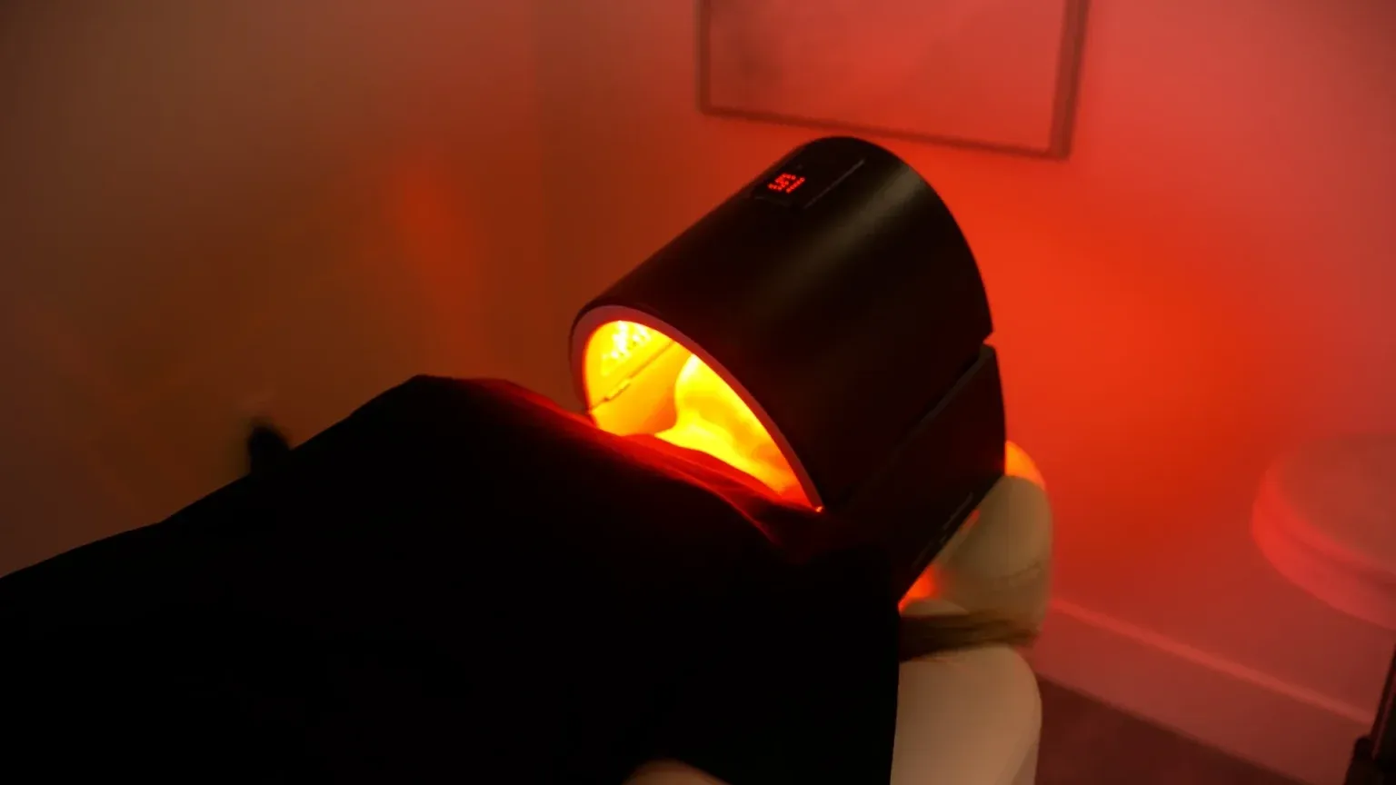 PicoWay Tattoo Removal Gallery 2