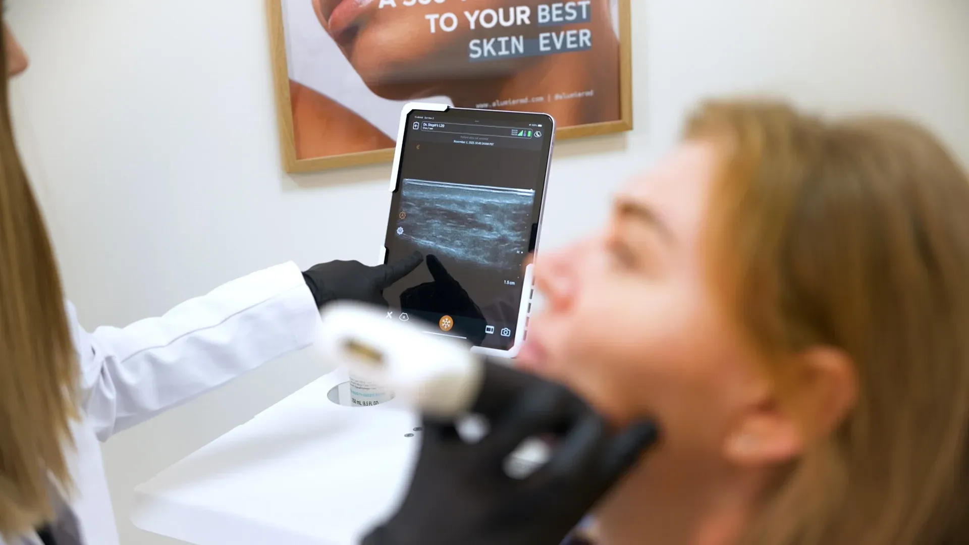 PicoWay Tattoo Removal Gallery 5