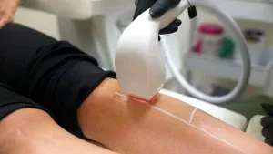 PicoWay Tattoo Removal Gallery 2