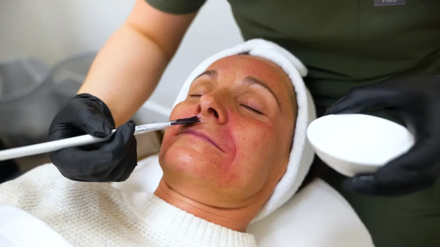 PicoWay Tattoo Removal Gallery 2