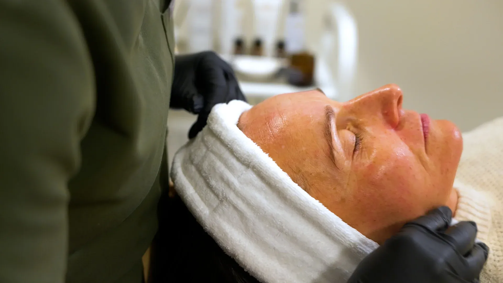 PicoWay Tattoo Removal Gallery 3