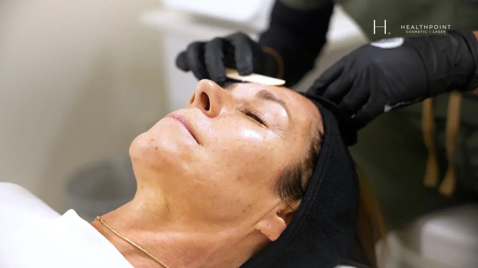 PicoWay Tattoo Removal Gallery 6
