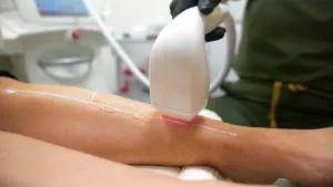 PicoWay Tattoo Removal Gallery 8