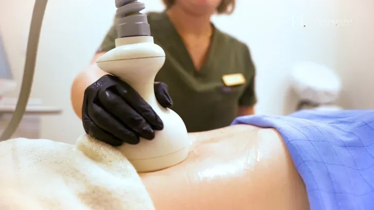 PicoWay Tattoo Removal Gallery 7