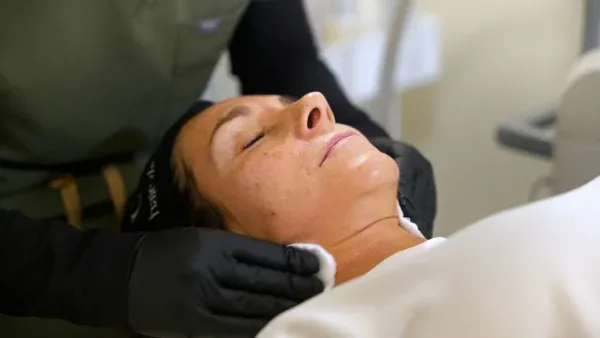 PicoWay Tattoo Removal Gallery 7