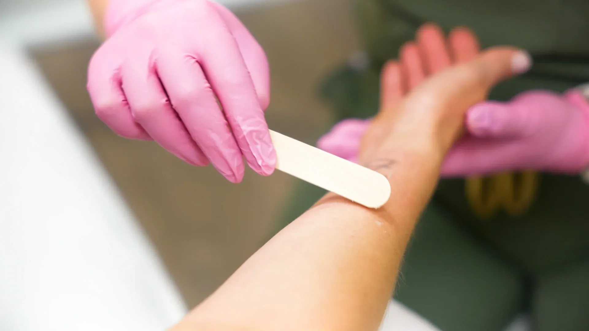 PicoWay Tattoo Removal Gallery 2