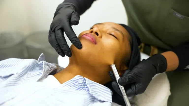 Benefits of Dermaplaning Kelowna