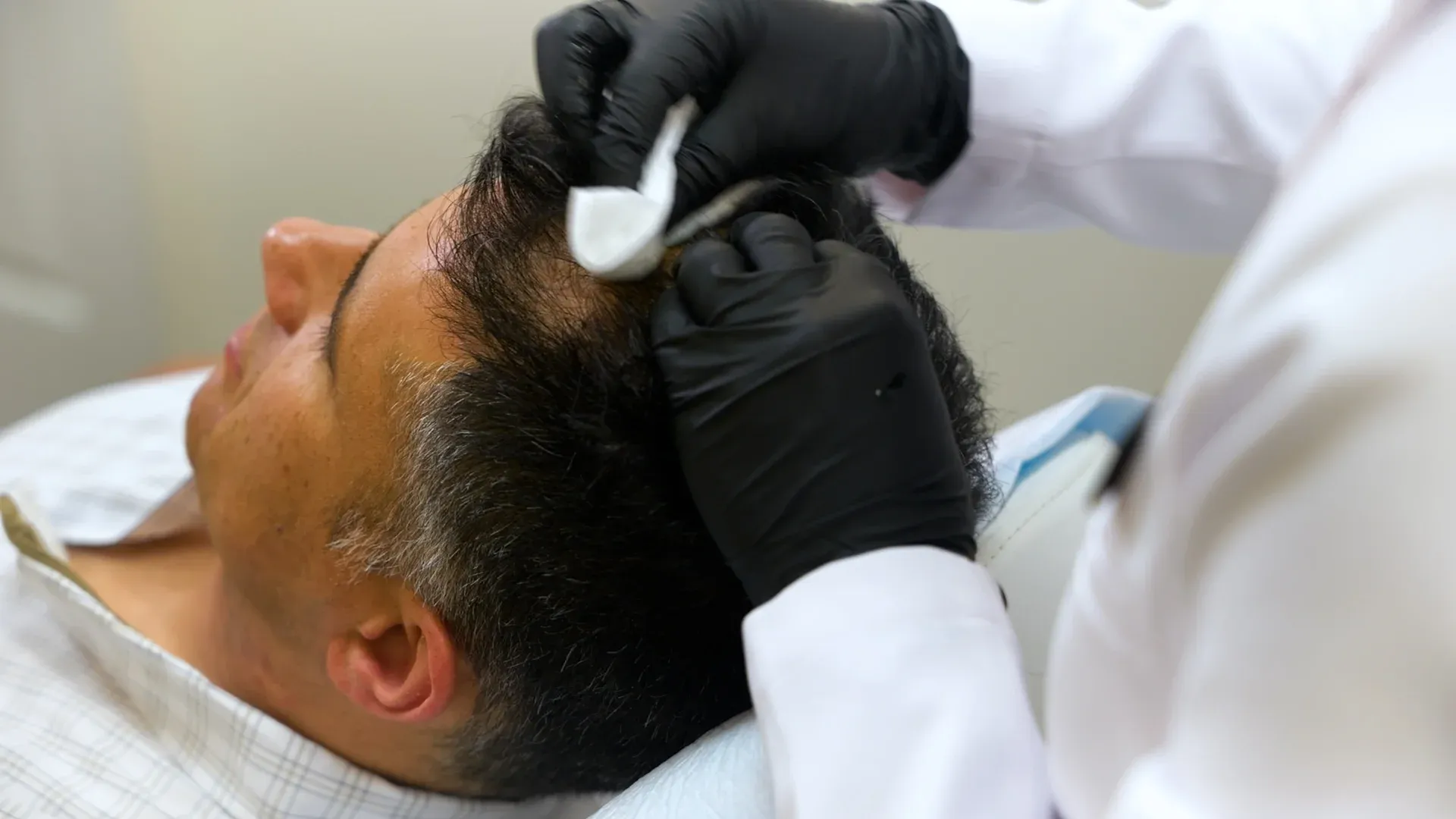 PicoWay Tattoo Removal Gallery 4