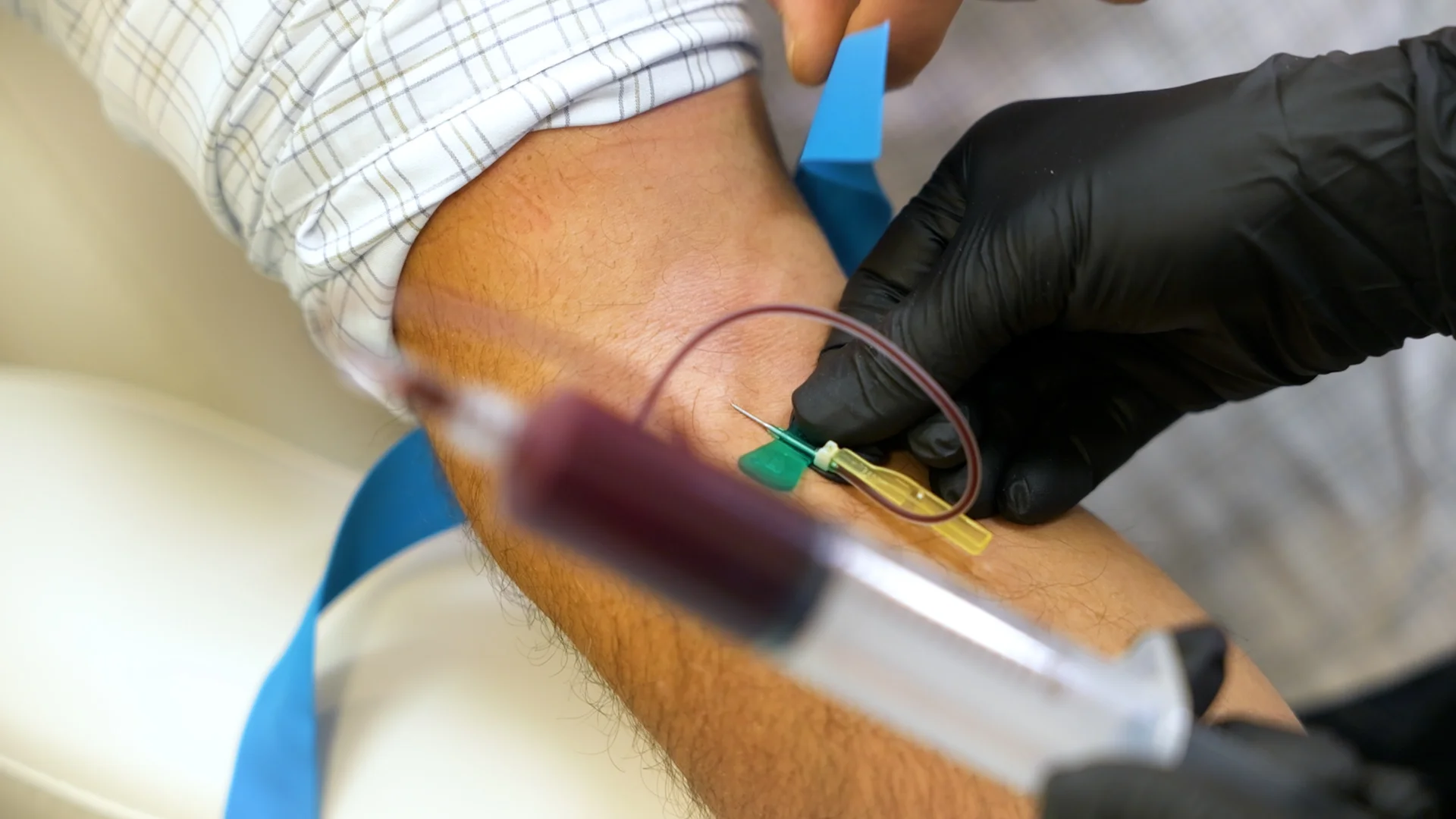PicoWay Tattoo Removal Gallery 4